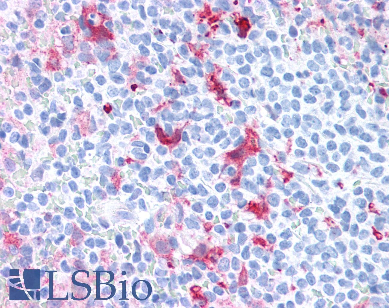 PathPlus™ FSCN1 / Fascin Antibody