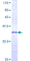 Human ADCY2 / Adenylate Cyclase 2 Protein (Recombinant GST, N-terminus)