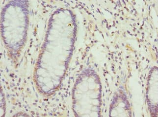 Polyclonal Rabbit anti-Human NFS1 Antibody (IHC, WB)