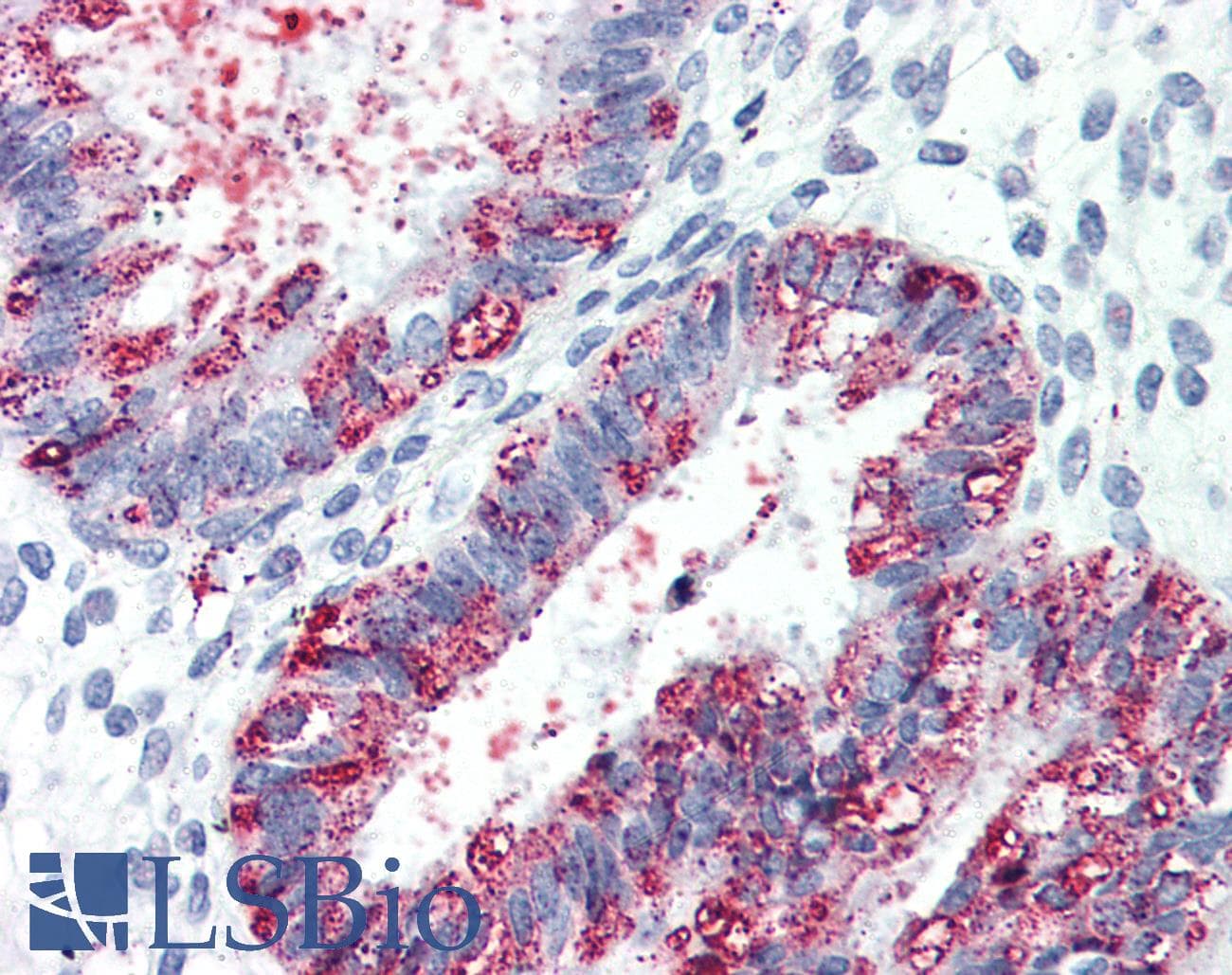 IHC-plus™ Polyclonal Rabbit anti-Human GPR27 Antibody (Cytoplasmic Domain, IHC)