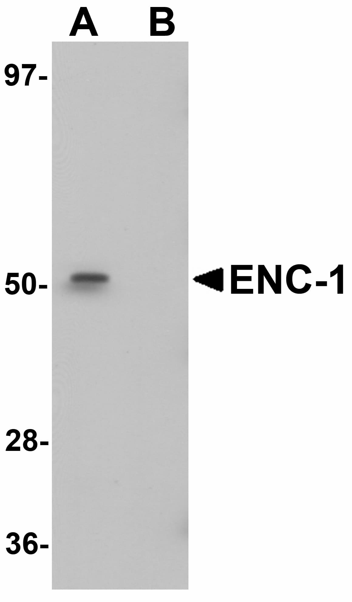 Polyclonal Chicken anti-Human ENC1 Antibody (IHC, IF, WB)