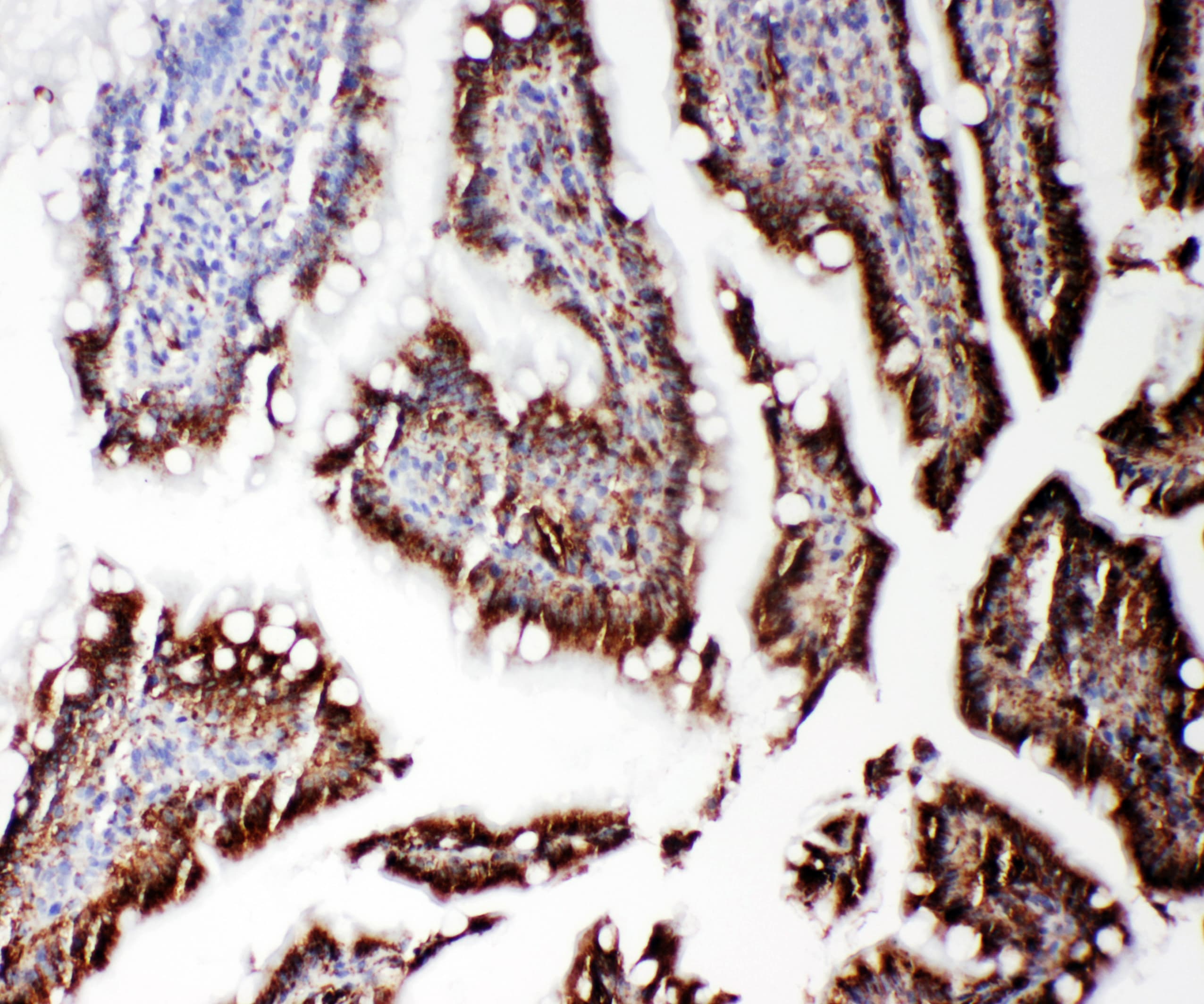 Polyclonal Rabbit anti-Mouse RGS3 Antibody (aa909-925, IHC, WB)