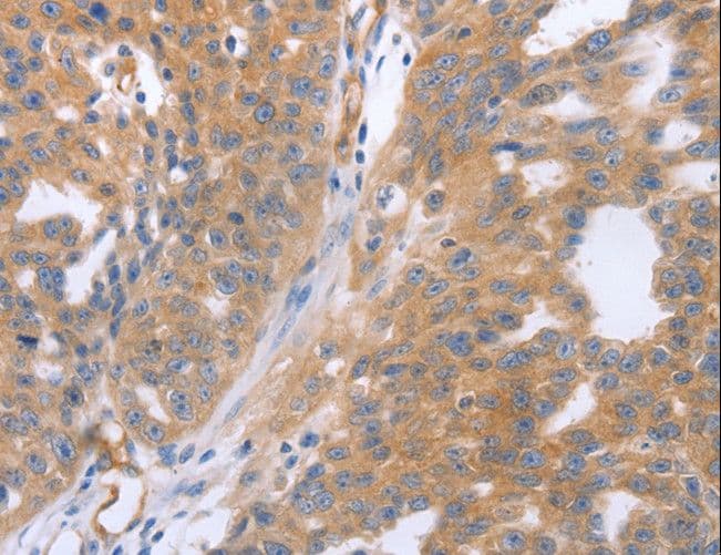 NRTN / Neurturin Antibody