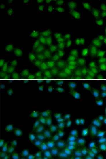 Polyclonal Rabbit anti-Human SFRP2 Antibody (IHC, IF, WB)