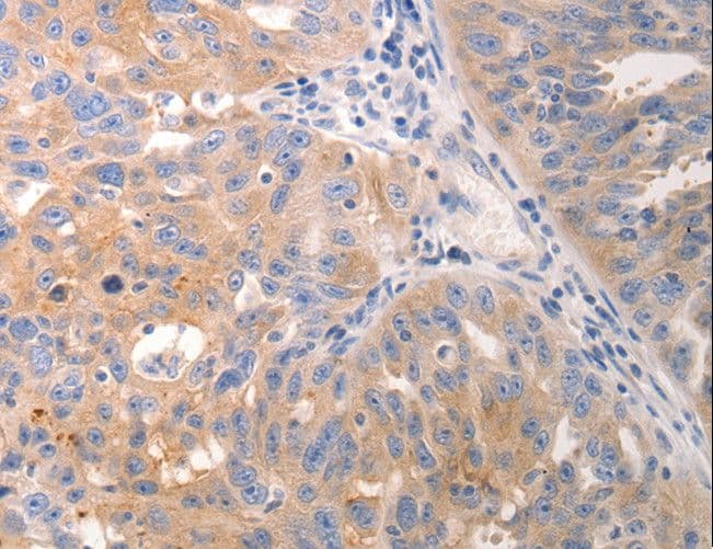 KRT6 / CK6 / Cytokeratin 6 Antibody
