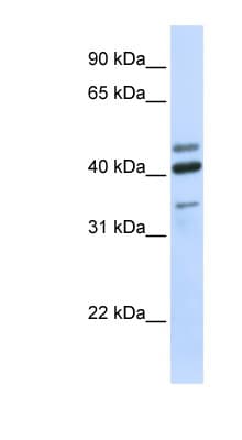 HYAL1 Antibody (aa72-121)