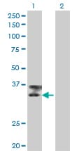 TTN / Titin Antibody (clone 6H5)
