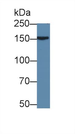 APOB / Apolipoprotein B Antibody (aa3329-3494, PE)