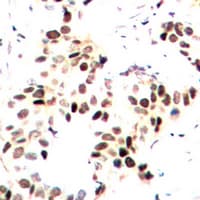 MEF2A / MEF2 Antibody (phospho-Thr312)