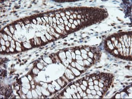 PYCARD / ASC / TMS1 Antibody (clone OTI3E9, Carrier-free)