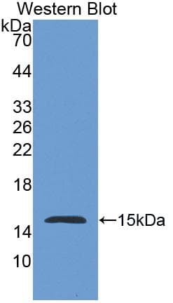 NPHS1 / Nephrin Antibody (aa23-130, PE)