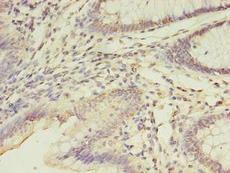 FGL2 Antibody (aa24-439)
