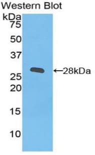 ITGB2 / CD18 Antibody (aa431-652, Cy3)