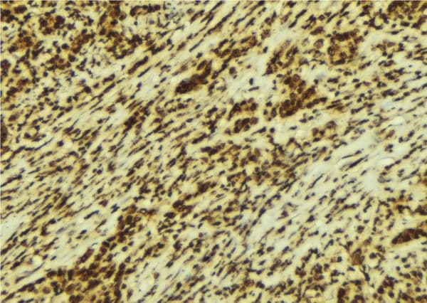 SMC1A / SMC1 Antibody
