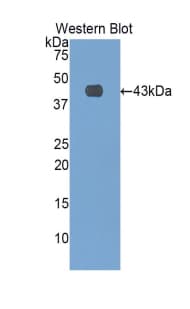 SELE / CD62E / E-selectin Antibody (aa142-245)