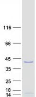 Human WDR5 Protein (Recombinant Myc-DDK (Flag))