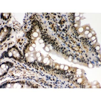 REL / C-Rel Antibody (aa268-306)