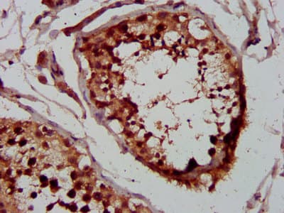 Polyclonal Rabbit anti-Human WHSC1 / NSD2 Antibody (IHC, IF)