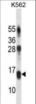 MD-1 / LY86 Antibody (aa98-127)