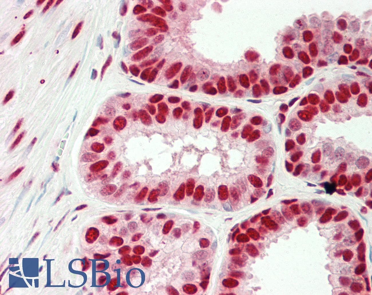 Polyclonal Rabbit anti-Human HMG1 / HMGB1 Antibody (aa121-170, IHC, WB)