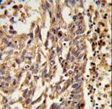 KIF11 / EG5 Antibody (aa103-130)
