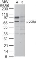 IHC-plus™ Polyclonal Rabbit anti-Human IL20RA Antibody (aa159-175, IHC, WB)