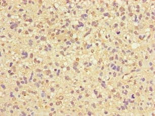 ZNF365 Antibody