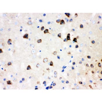ABI1 / SSH3BP1 Antibody (aa151-175)