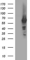 TH / Tyrosine Hydroxylase Antibody (clone OTI2E6)