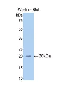 HP / Haptoglobin Antibody (aa177-342)