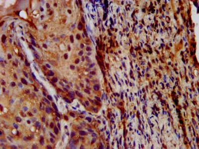 LIPH / Lipase Member H Antibody