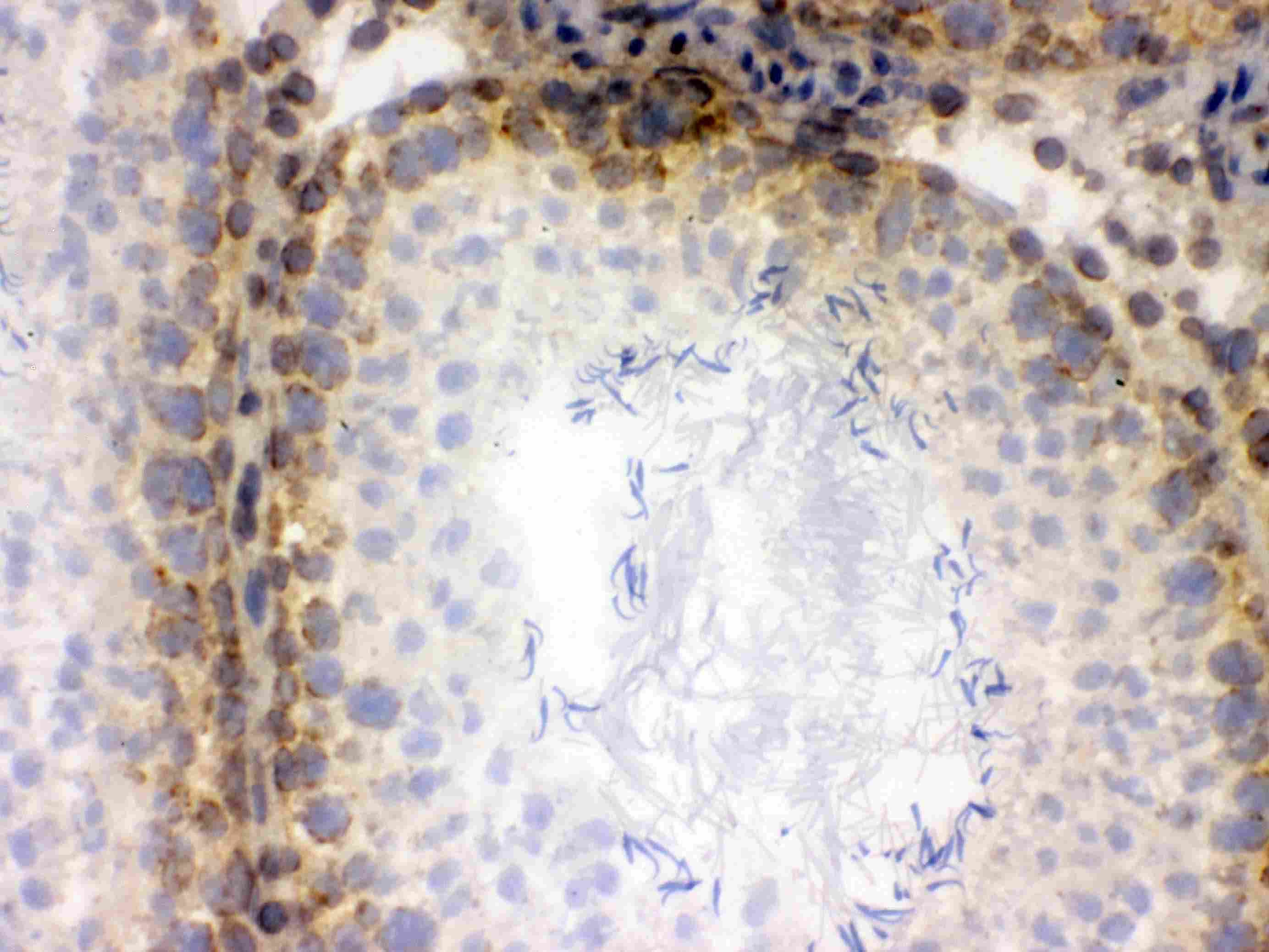XPO1 / CRM1 Antibody