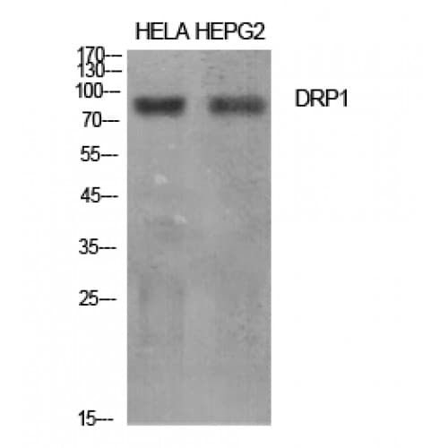 DNM1L / DRP1 Antibody (580-660 aa)