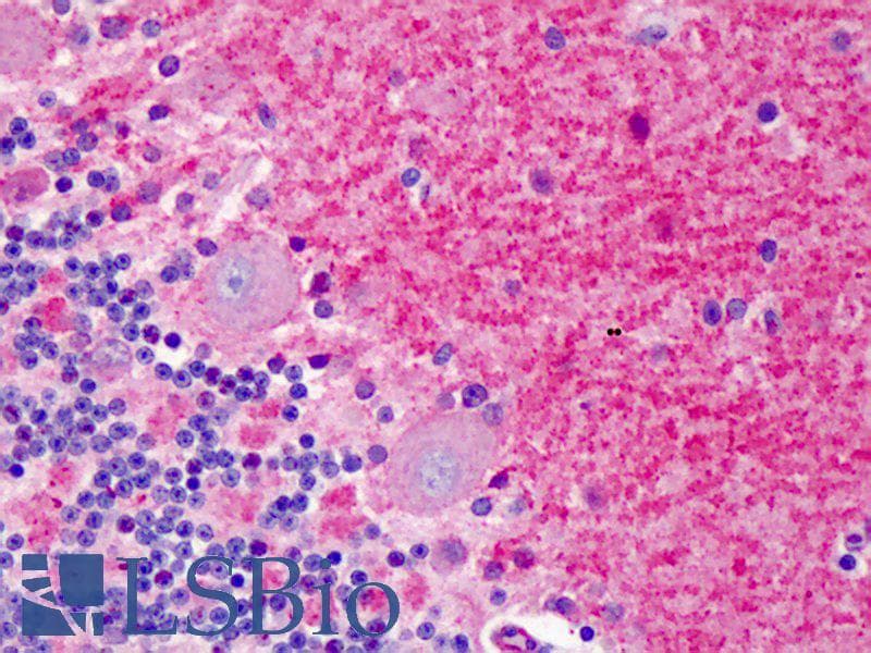 PathPlus™ DLG4 / PSD95 Antibody (C-Terminus)