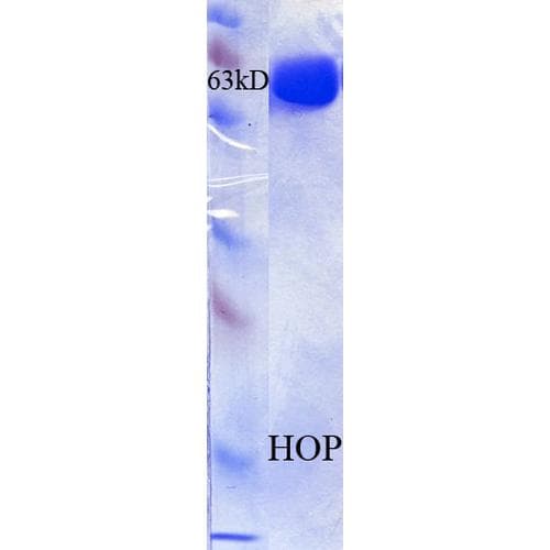 Human HOPX / HOP Protein (Recombinant His)