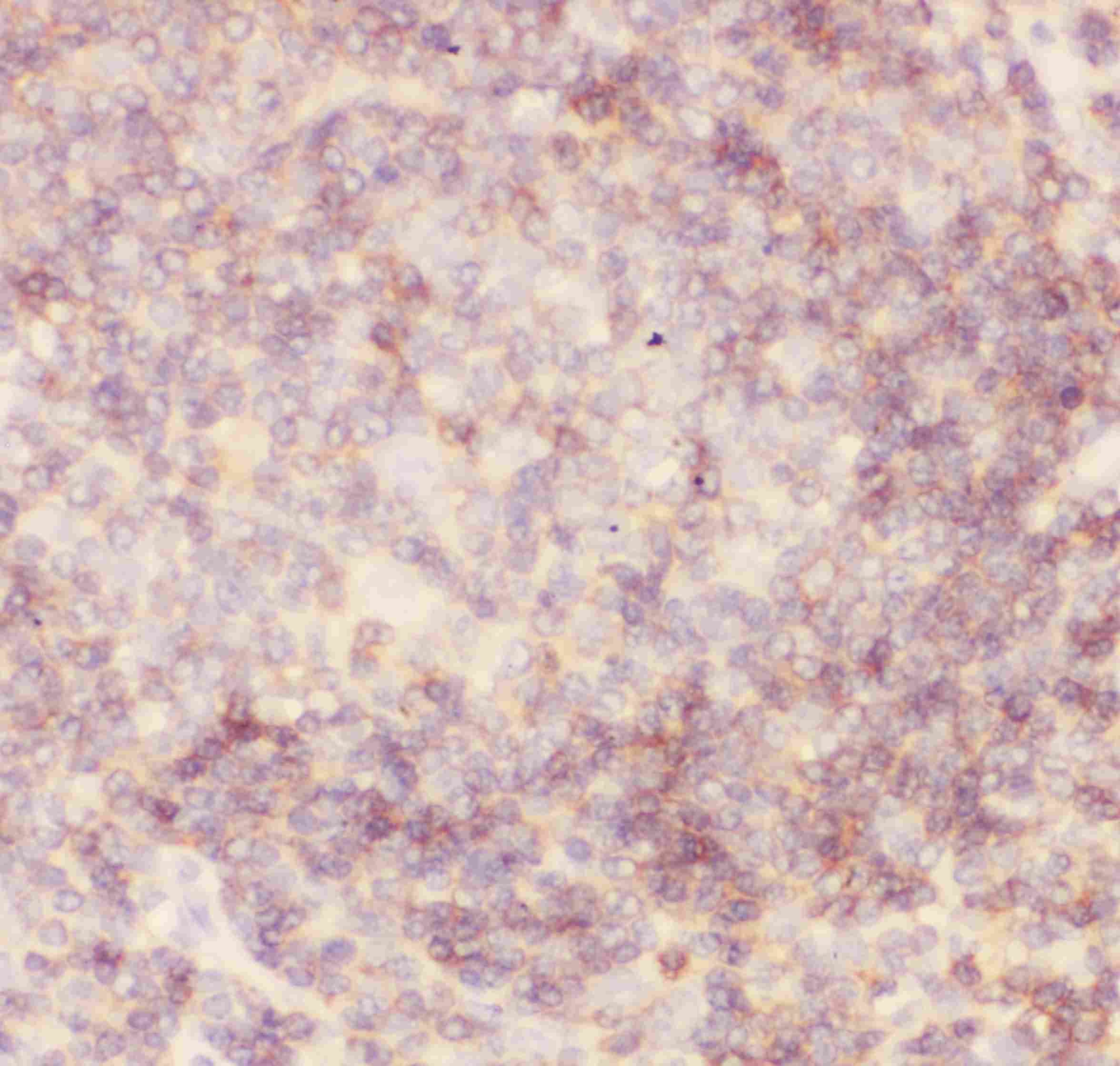 Polyclonal Rabbit anti-Human CD45 / LCA Antibody (aa1113-1304, IHC, WB)