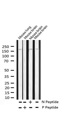 Polyclonal Rabbit anti-Human MED1 / TRAP220 Antibody (phospho-Thr1457, IHC, IF, WB)