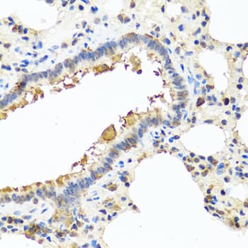 YKL39 / CHI3L2 Antibody