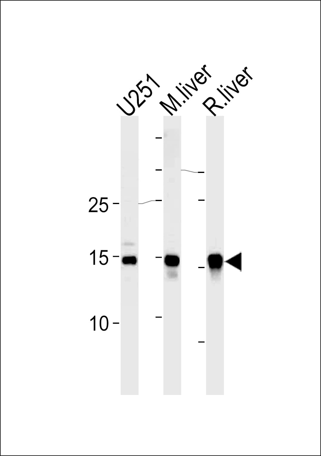 IHC-plus™ SUMO2 + SUMO3 Antibody (aa49-81)