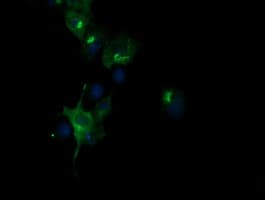 CHGA / Chromogranin A Antibody (clone OTI1G3)