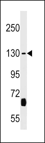 KIF27 Antibody (aa1372-1401)