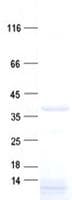 Human C3orf38 Protein (Recombinant His, N-Terminal)