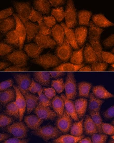 RPAP3 / FLJ21908 Antibody