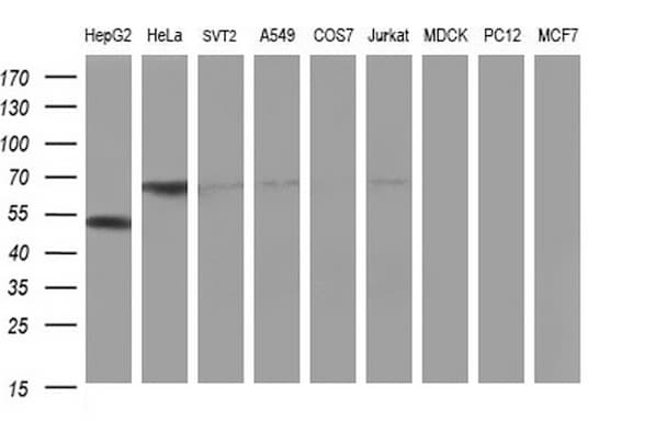 FGG / Fibrinogen Gamma Antibody (clone OTI1D11)
