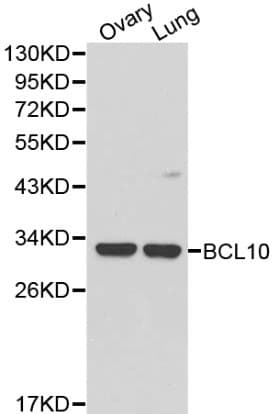 BCL10 / BCL-10 Antibody