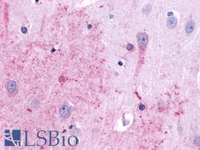 PathPlus™ Polyclonal Rabbit anti-Human TACR3 / NK3R Antibody (N-Terminus, IHC)