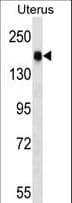 CGNL1 Antibody (aa317-344)
