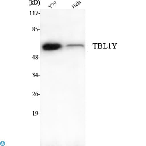 Monoclonal Mouse anti-Human TBL1Y / TBL1 Antibody (WB)