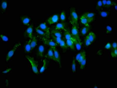 TGM2 / Transglutaminase 2 Antibody
