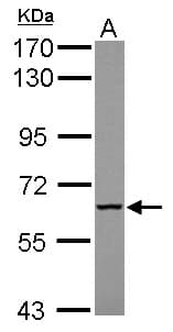 MTMR9 Antibody